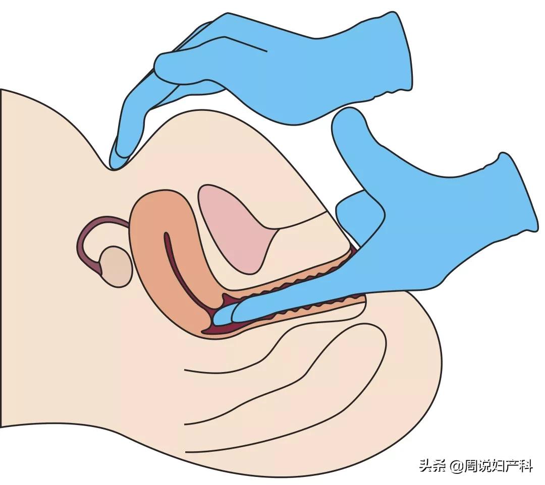 第一次看妇科竟然花了7000块!这份妇科避坑指南快收好