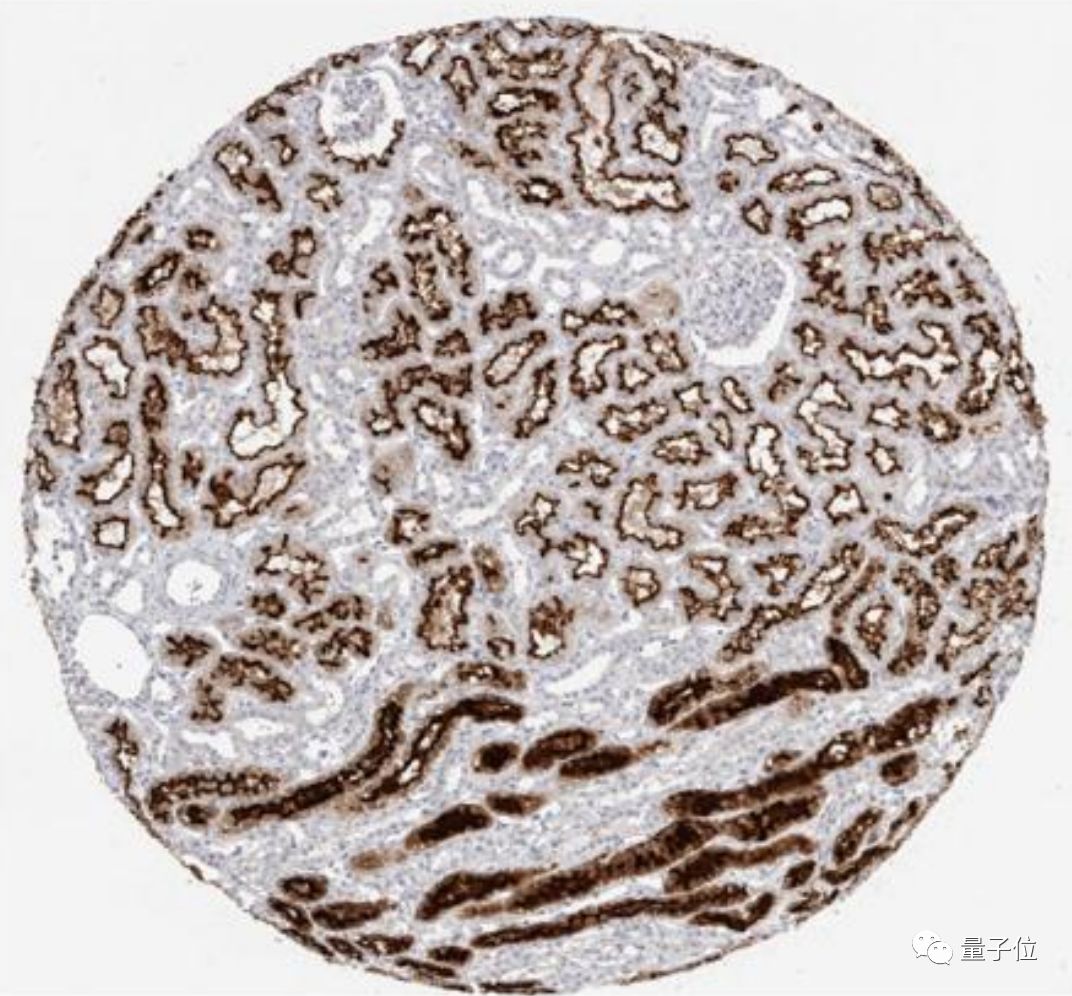 新冠睾丸损伤,新冠损伤睾丸