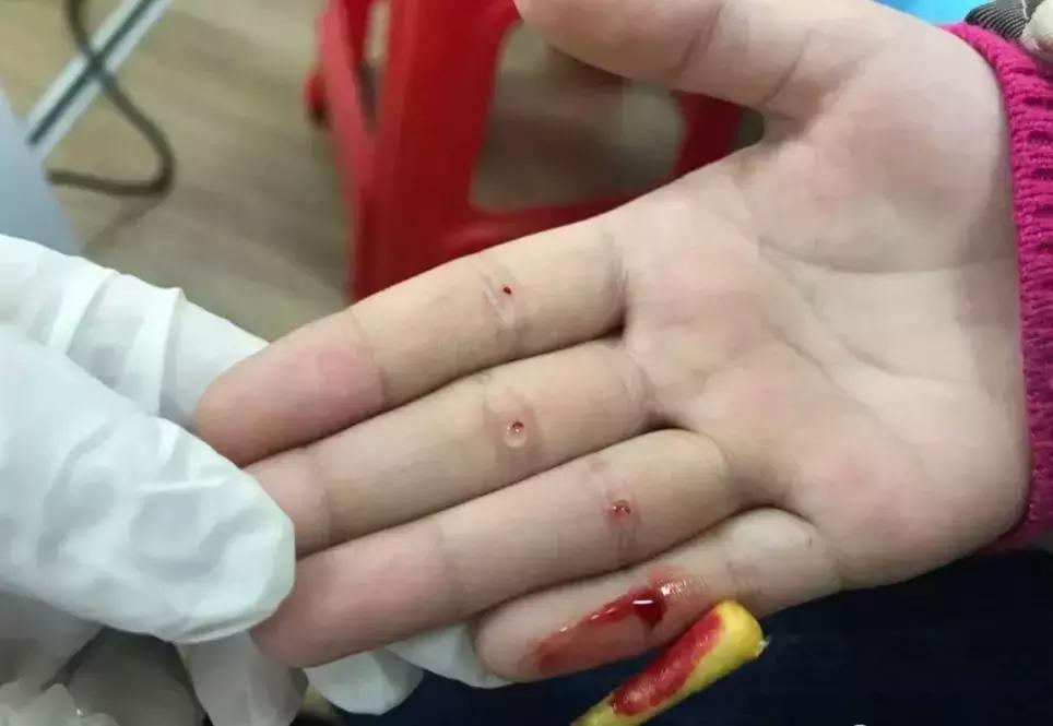 祝你快高长大：刘医生小儿增高临床心得