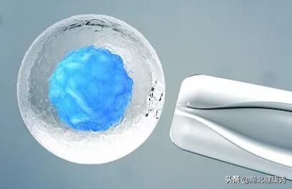 做试管婴儿应该知道的6个真相,做试管婴儿的常见问题