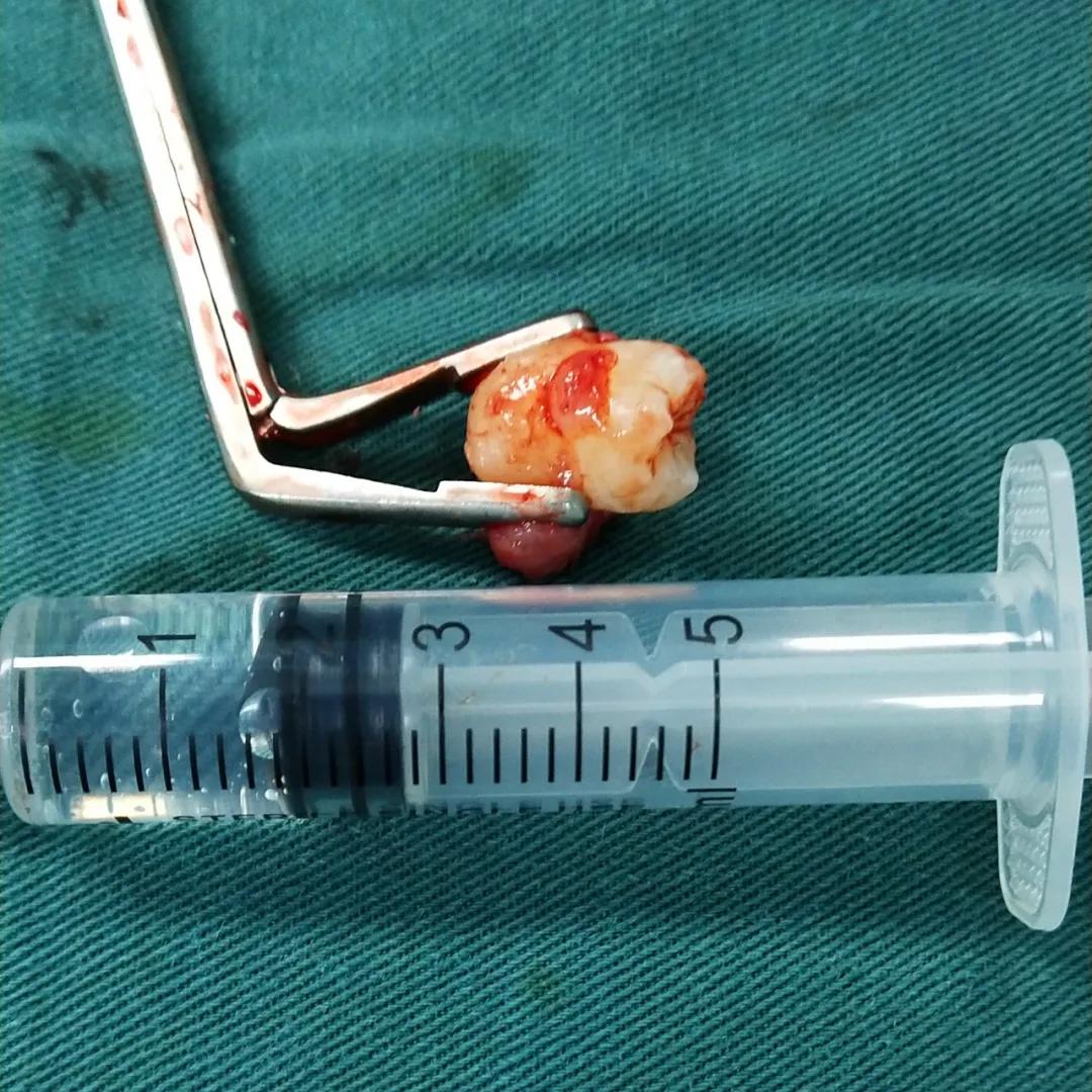 医院里的硬核技术,硬核医生硬核技术