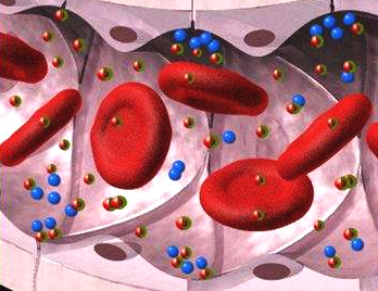 胆结石患者喝酒会眩晕吗,胆结石喝酒引发胆囊炎