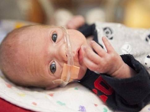 医院要求早产宝宝袋鼠式护理,早产宝宝袋鼠抱妈妈要穿内衣吗