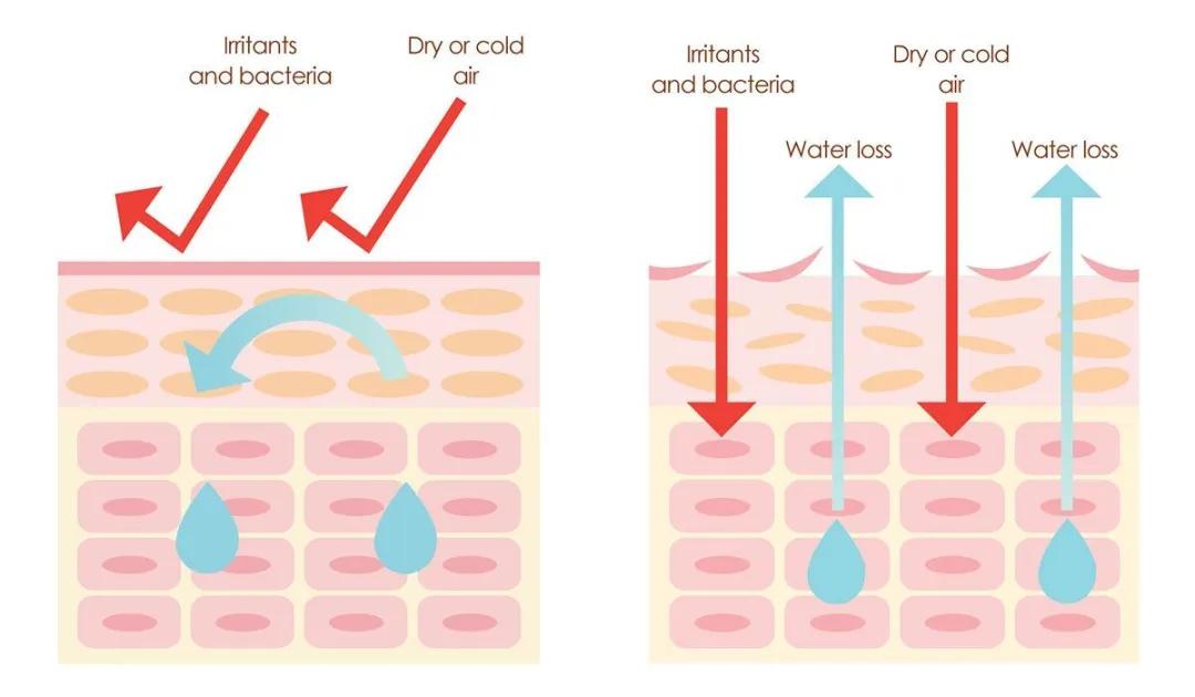 皮肤屏障受损怎么修复最简单有效,可预修复皮肤屏障受损的医用产品