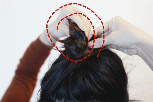 扁头怎么让头变得饱满些,扁头怎么办最快最有效