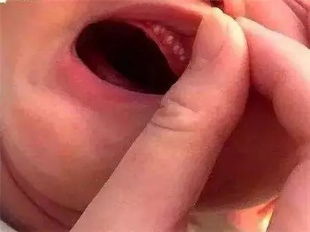 新手爸妈必看宝宝出现这6种症状,当妈妈需要知道什么