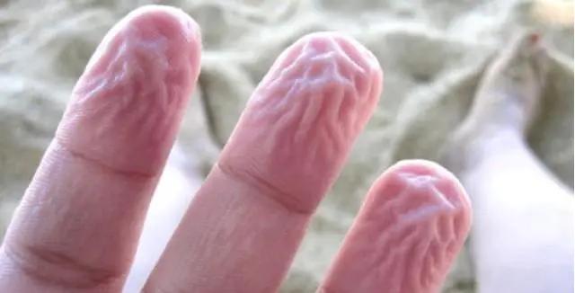 手指泡水后发白像烂了,手指泡水后出现大白泡