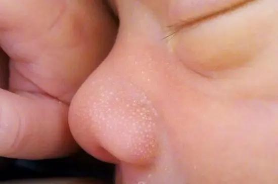 新生宝宝的这些现象令人担忧？有些不必担心，但有些一定要注意