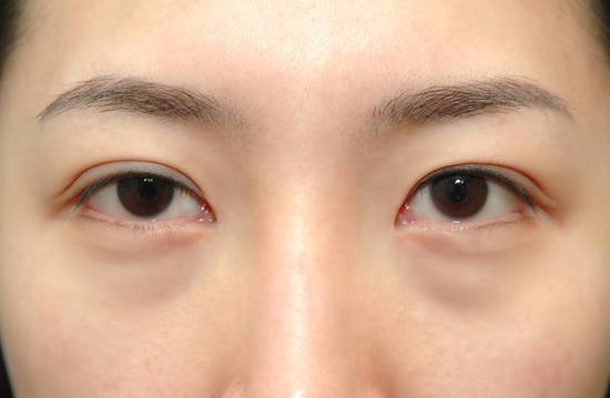 睡觉敷完面膜后的正确护肤步骤,睡前敷完面膜怎么护肤