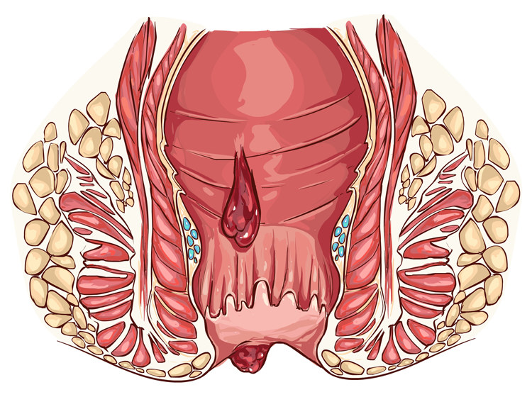 多才多“痔”?久坐的你是否也掌握了“痔慧”的奥义