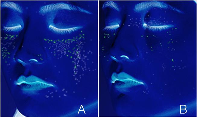 氨甲环酸美白精华,氨甲环酸日本