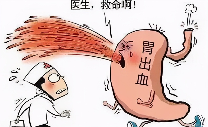 胃出血能死人吗,胃出血严重了能死人吗