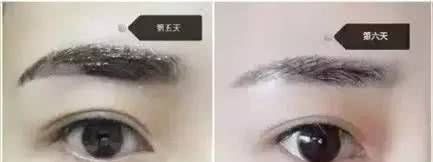 刚做完眉毛有点红,刚做完眉毛浓粗正常吗