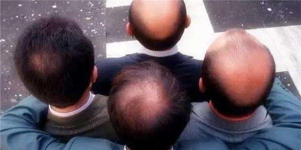 脱发怎么治一年四季都掉发,脱发严重快秃了是什么原因