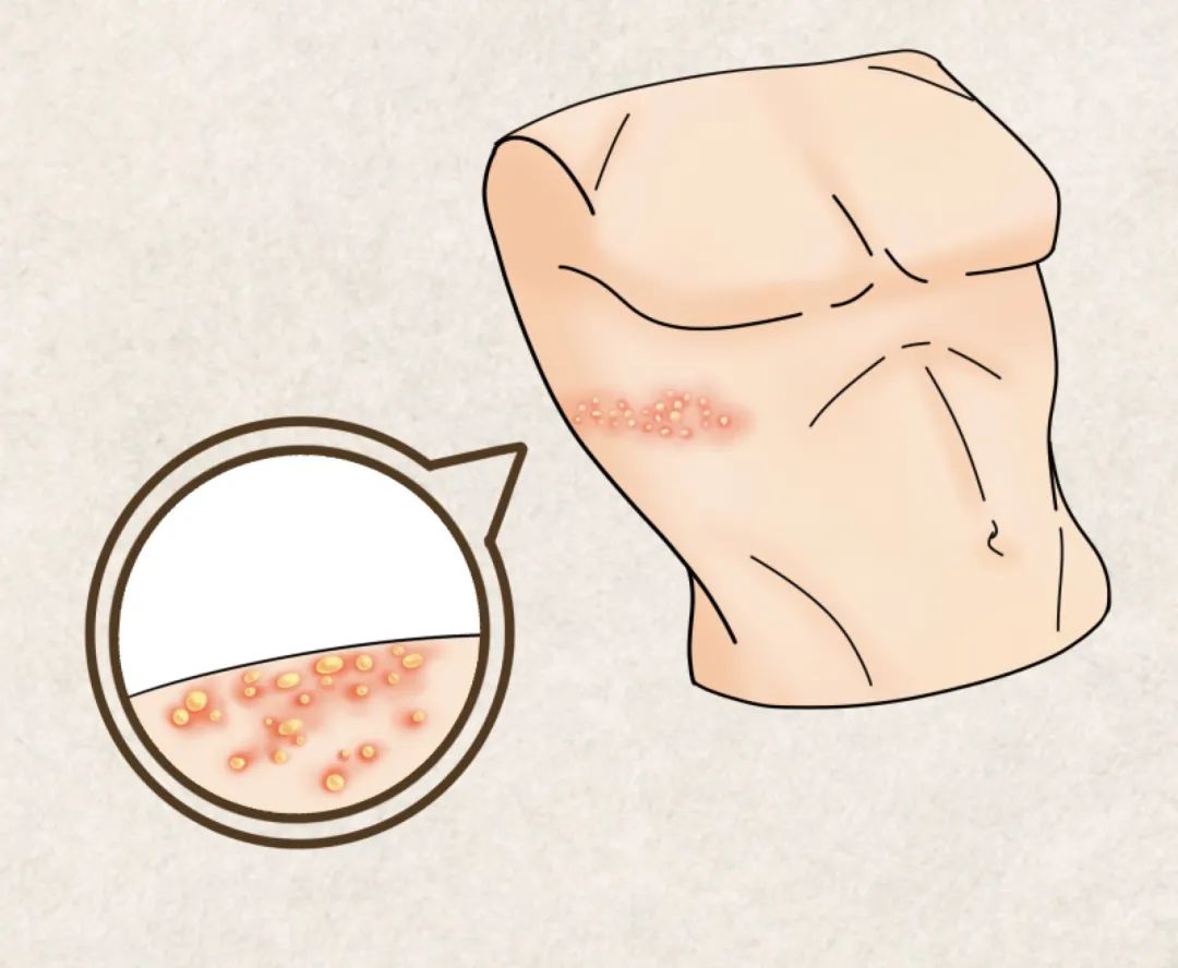 同事长了好多疮会传染吗,同事皮肤病会传染吗