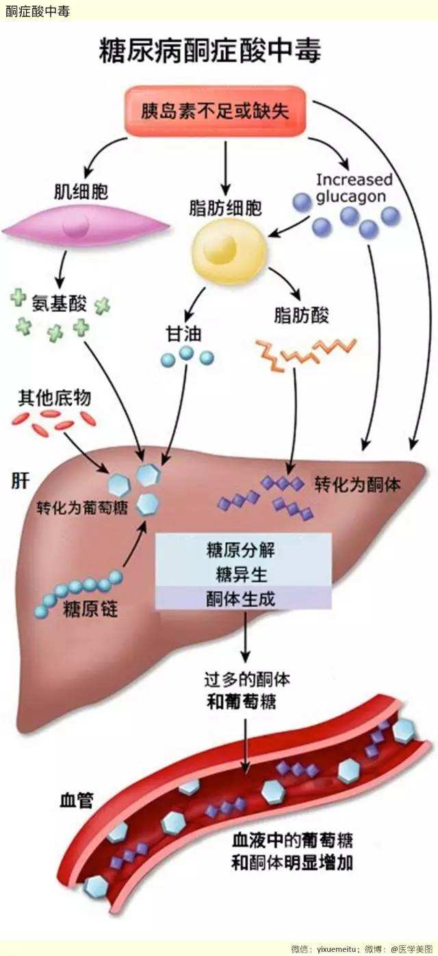 口服二甲双胍的副作用和禁忌,服用二甲双胍要注意的事项