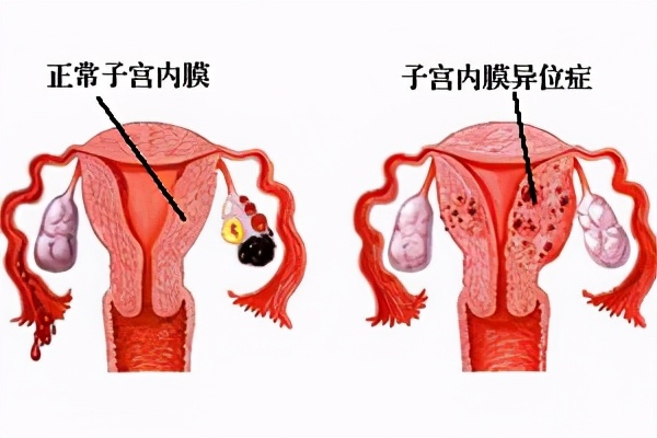 有妇科病的女人会影响男人么,有妇科病怀孕了对胎儿有影响吗