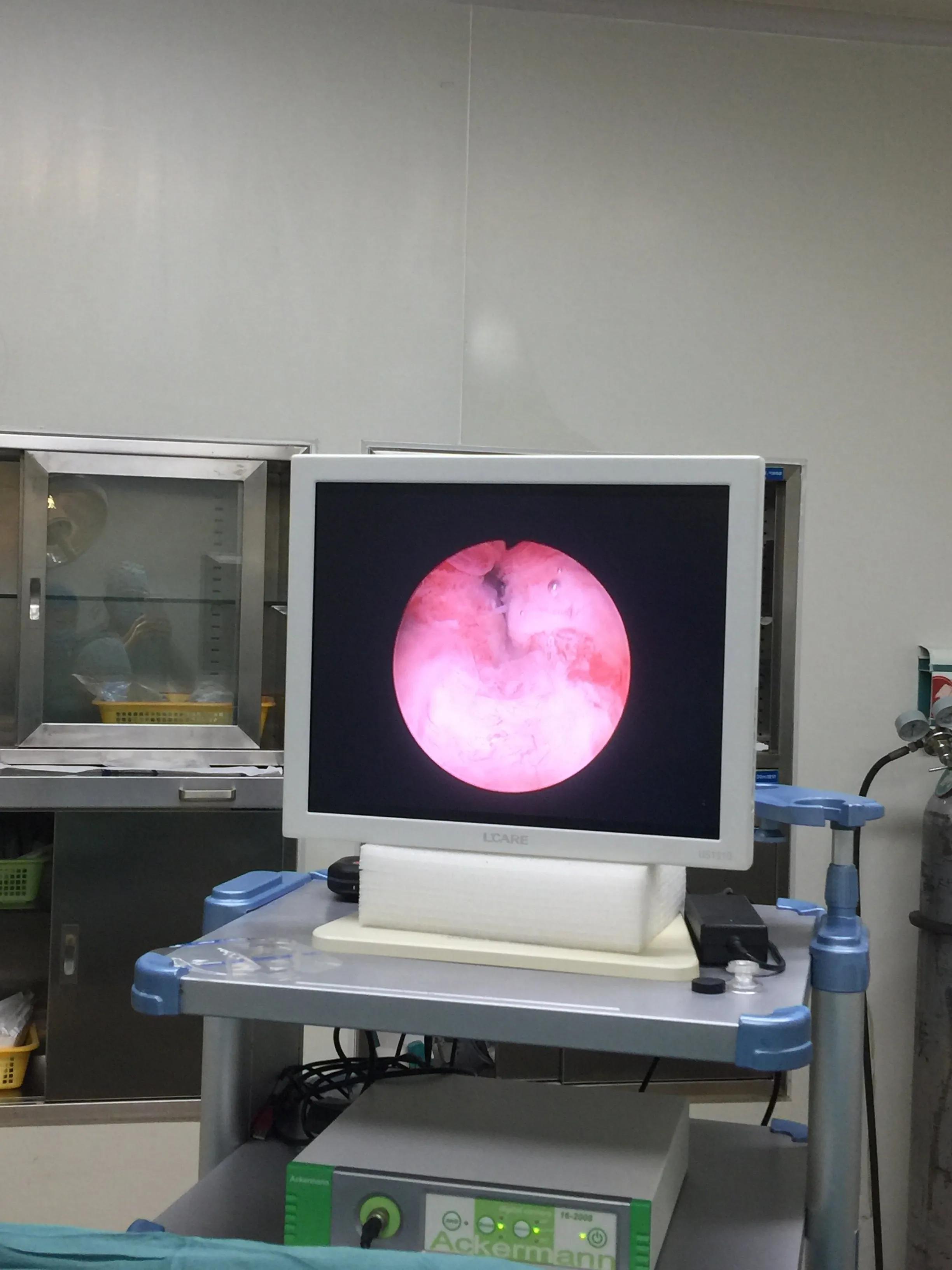 排不出尿中药验方,中医治疗排不出来尿