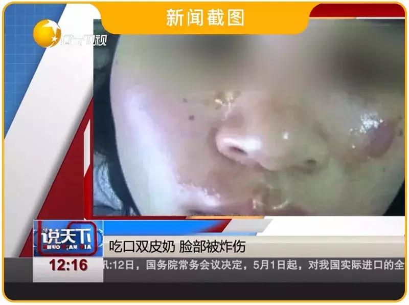 微波炉背面辐射大还是侧面辐射大,微波炉的辐射会对人体造成伤害吗