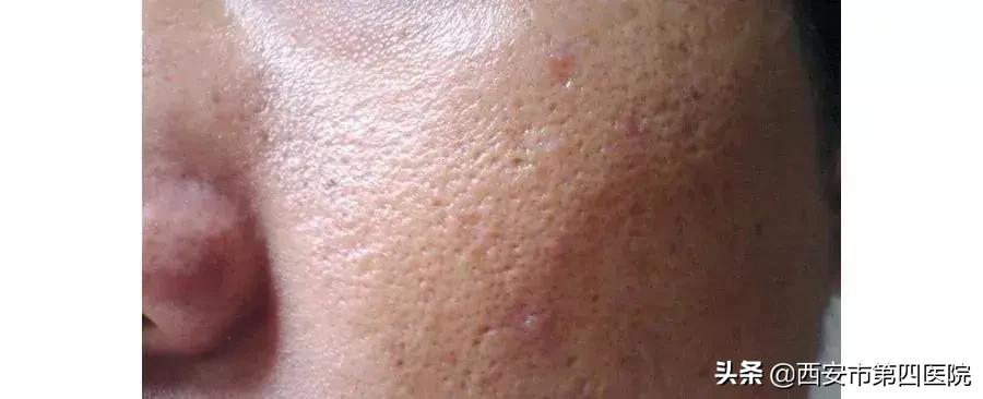 健康中国有哪些举措,健康中国行动攻略