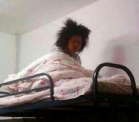 双眼皮术后晨起眼睛更肿？晨起眼睛肿胀的原因解析