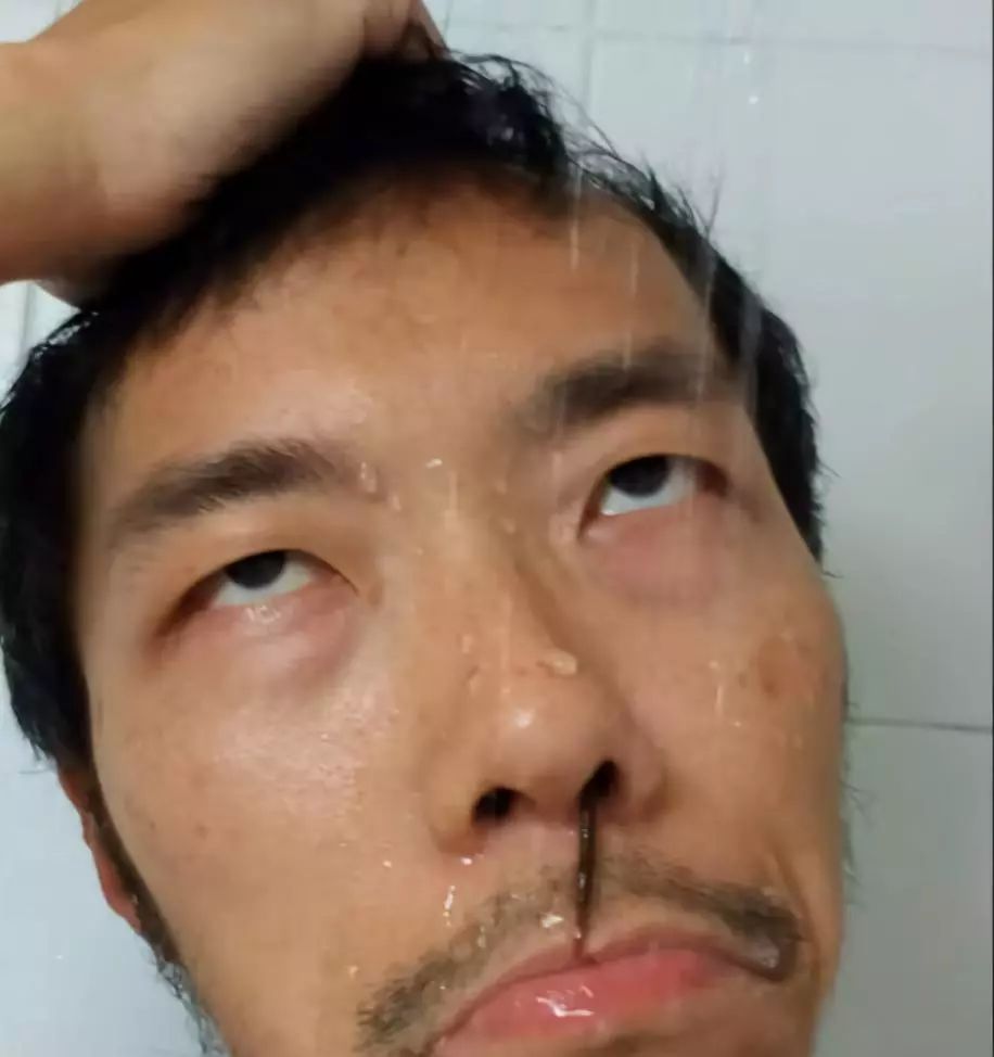 流鼻血的恐怖现象,流鼻血恐怖案例