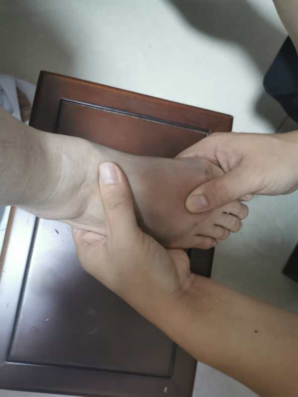 足背扭伤针灸治疗原理,董氏奇穴治踝关节扭伤