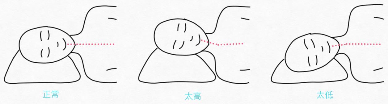 睡醒脖子痛一招搞定,睡醒脖子累怎么缓解