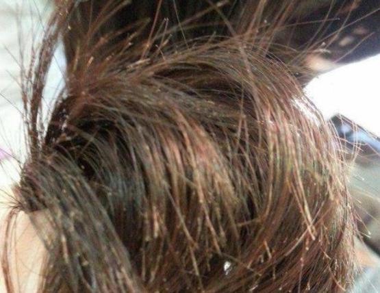 头发干枯毛躁怎么护发,头发很干枯毛躁怎么办用什么护发