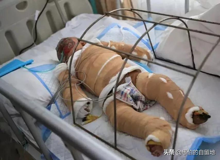 乡村纪事：偏方治大病，不识字的母亲，是个厉害的“土郎中”