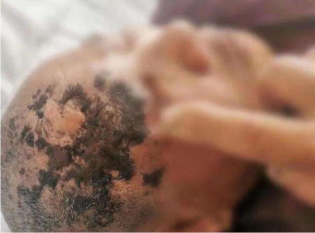 老太太为治病信偏方，剃光头发满脸涂墨汁！这病疼起来堪比生娃