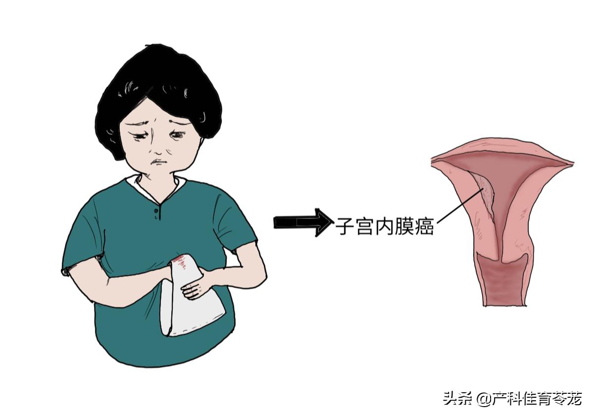 月经老不干净什么原因引起的,年龄50岁月经一直不干净