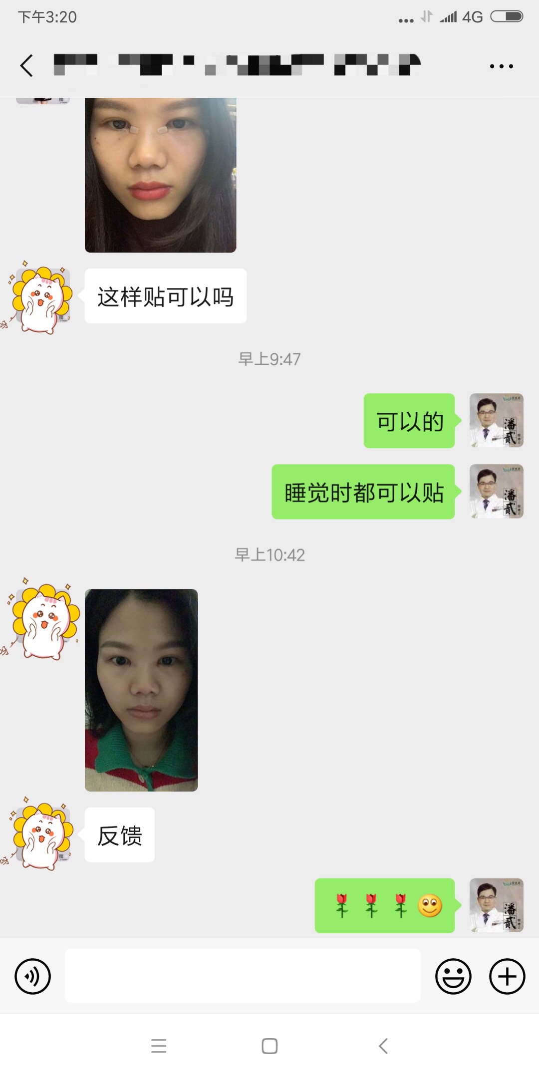 开内眼角会留疤的照片,开内眼角的疤痕变白色了怎么办