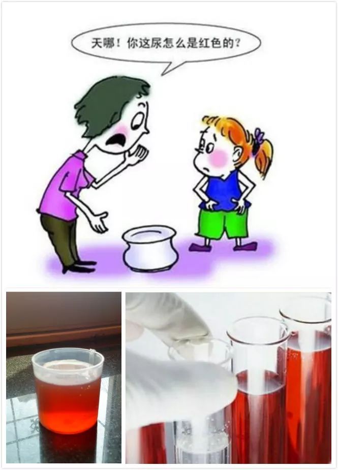 尿液发红是怎么回事正常吗,尿液发红是怎么了
