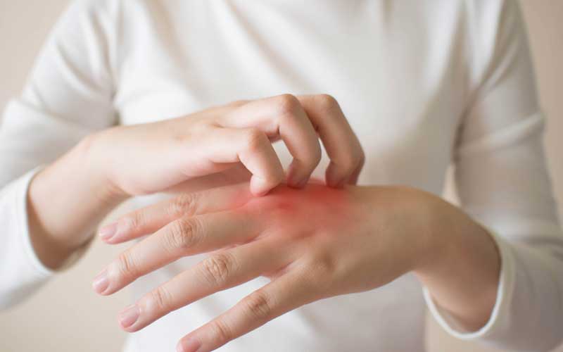 麻疹怎么回事,麻疹为什么会反复发痒