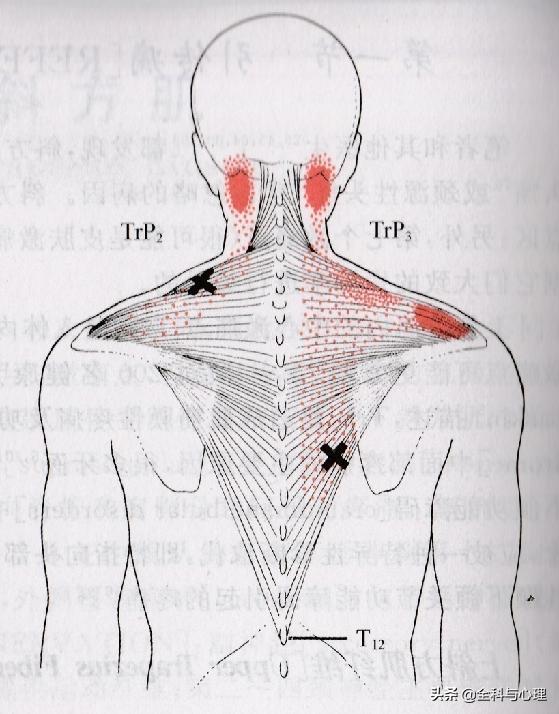中医如何治疗肩峰损伤,中医治疗软组织损伤案例方剂