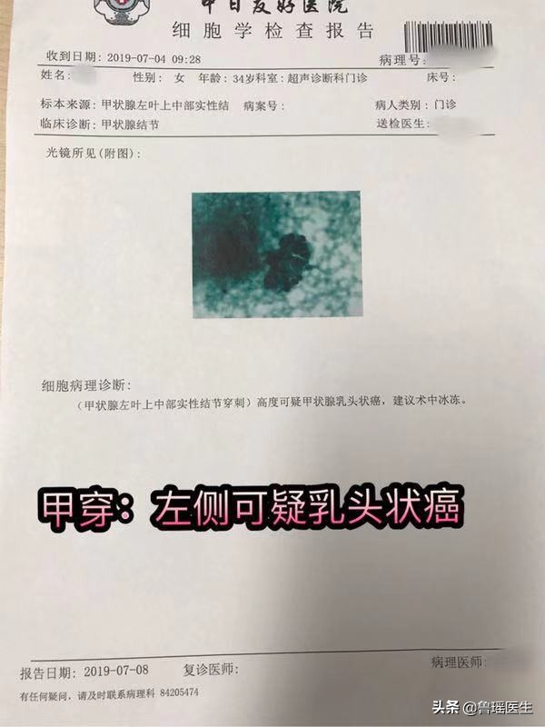 甲状腺癌手术后发现怀孕了能要吗,怀孕期间发现甲状腺癌