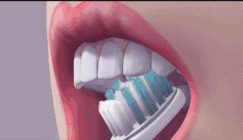 为什么每天刷牙还有那么多蛀牙,每天刷牙为什么蛀牙越来越多