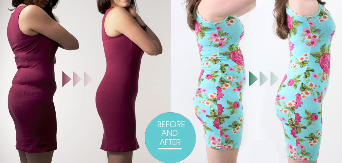 骨盆前倾穿塑身衣有用吗,别上当塑身衣真的有用吗