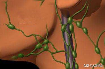 30岁颈部多个淋巴结肿大,二十岁淋巴结肿大会不会是淋巴癌
