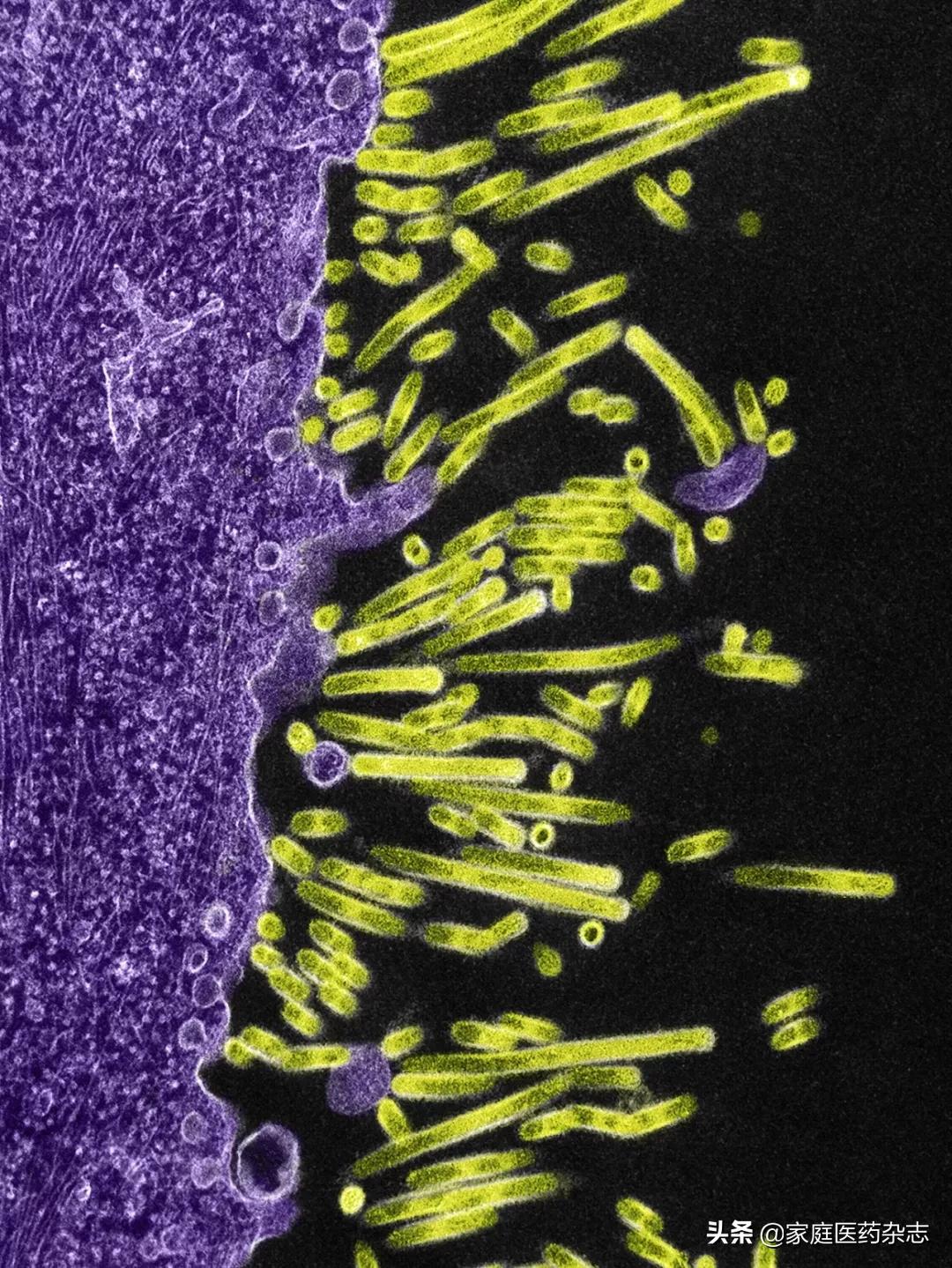鍋囧鐥呮瘨鎰熸煋浜嗘垜,鍋囧鐥呮瘨鎰熸煋浜嗕綘
