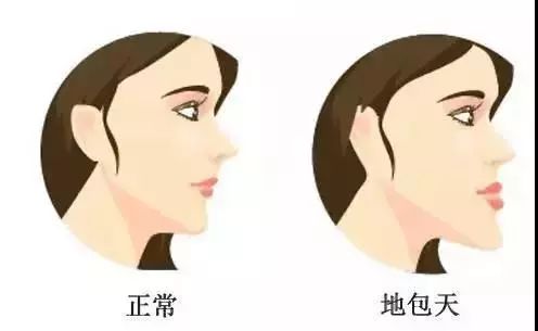 12岁前必须矫正的儿童牙颌畸形,孩子的牙错颌畸形还能矫正过来吗