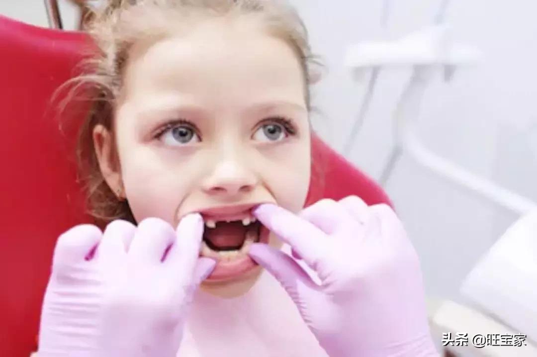 宝宝一直流口水是因为什么原因,宝宝经常流口水原因其实是这样的