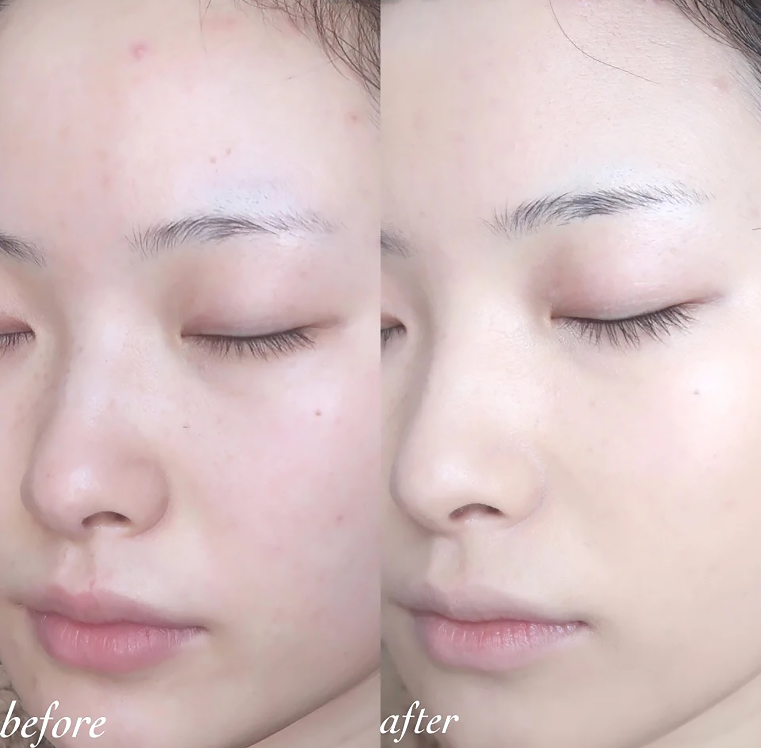 unny和uodo干皮粉底液哪个好,兰蔻po-01粉底液适合干皮还是油皮