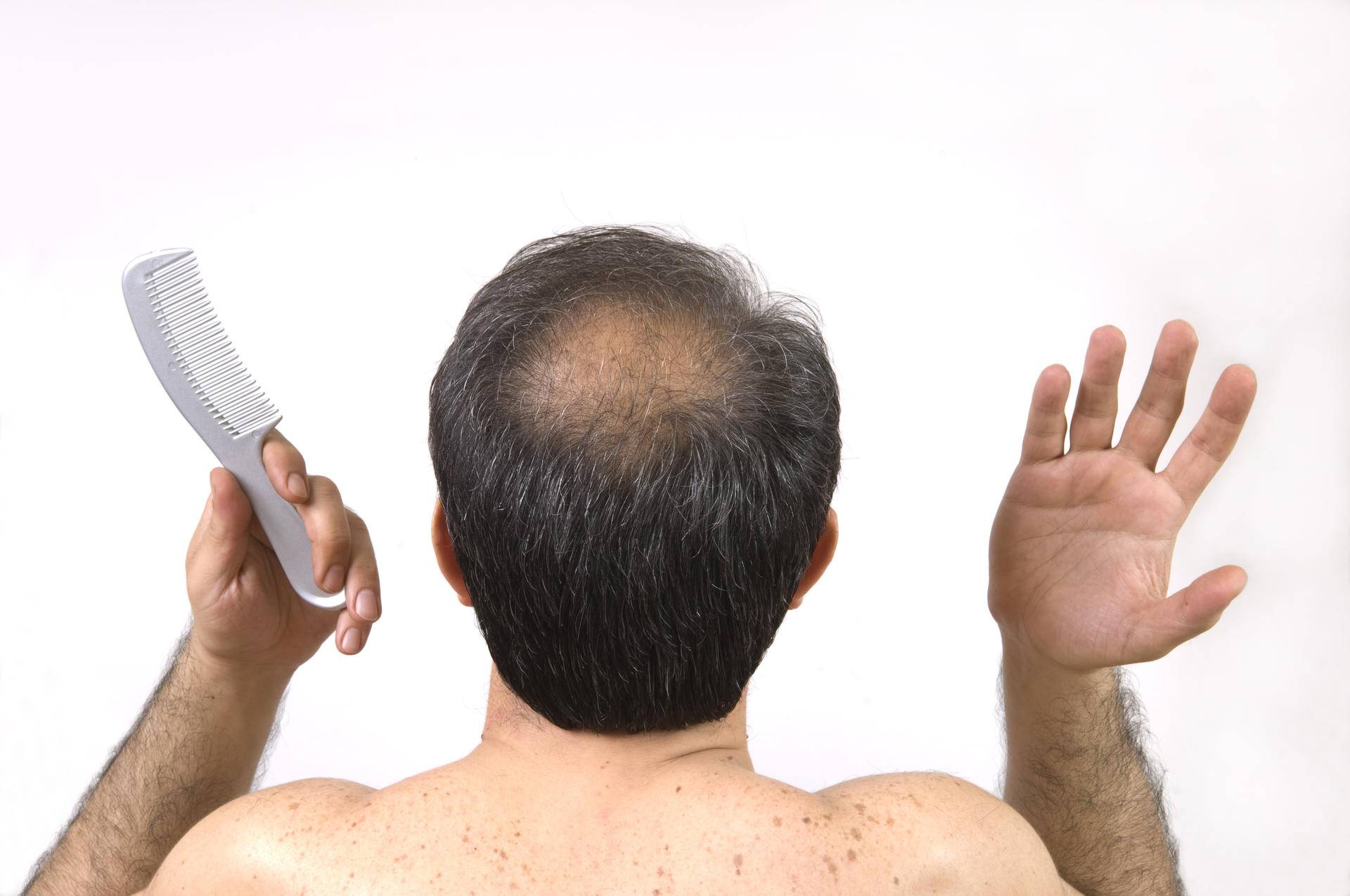 植发培训三天速成班,植发培训班真实感受