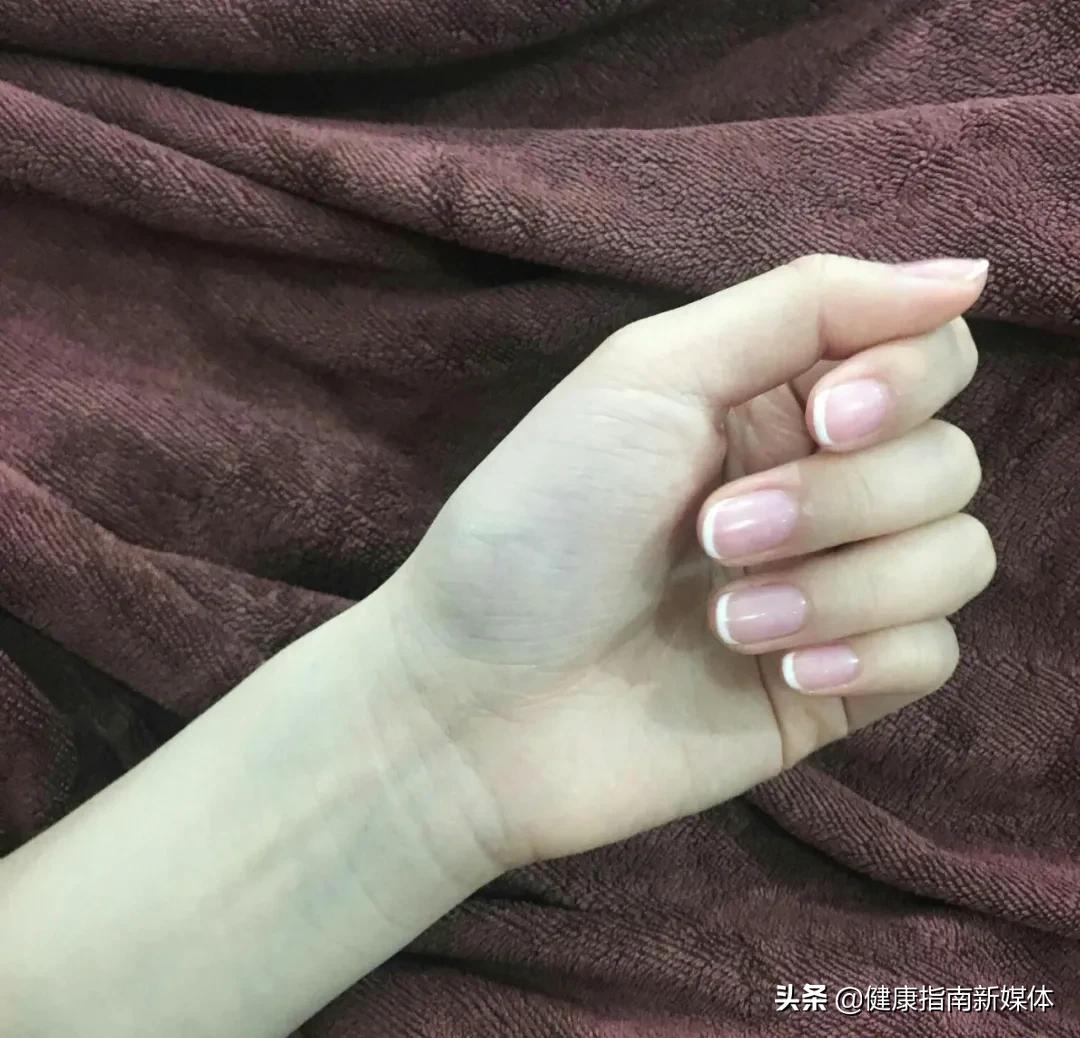 脚灰指甲的危害,灰指甲做饭有危害吗