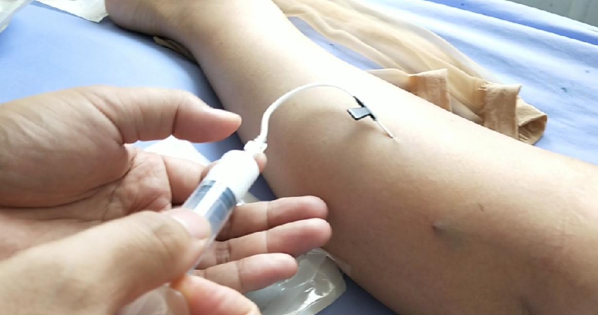 隔壁老王说静脉曲张可以打针治疗!这是真的吗?