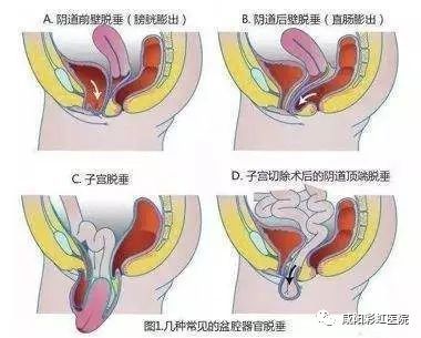 咸阳彩虹医院妇科咋样,咸阳彩虹医院妇产科怎么样