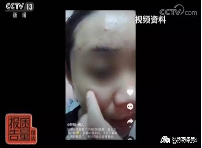 兰蔻面膜难闻,兰蔻面膜易过敏吗