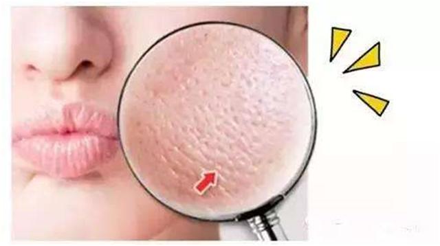 反孔大作战专治你的毛孔粗大